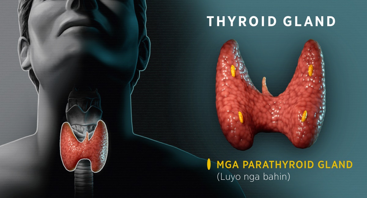 Collage: Mga dayagram nga nagpakita sa thyroid gland. 1. Atubangang bahin sa thyroid nga nagpakita sa nahimutangan niini sa liog. 2. Luyo nga bahin sa thyroid nga nagpakita sa mga parathyroid gland.