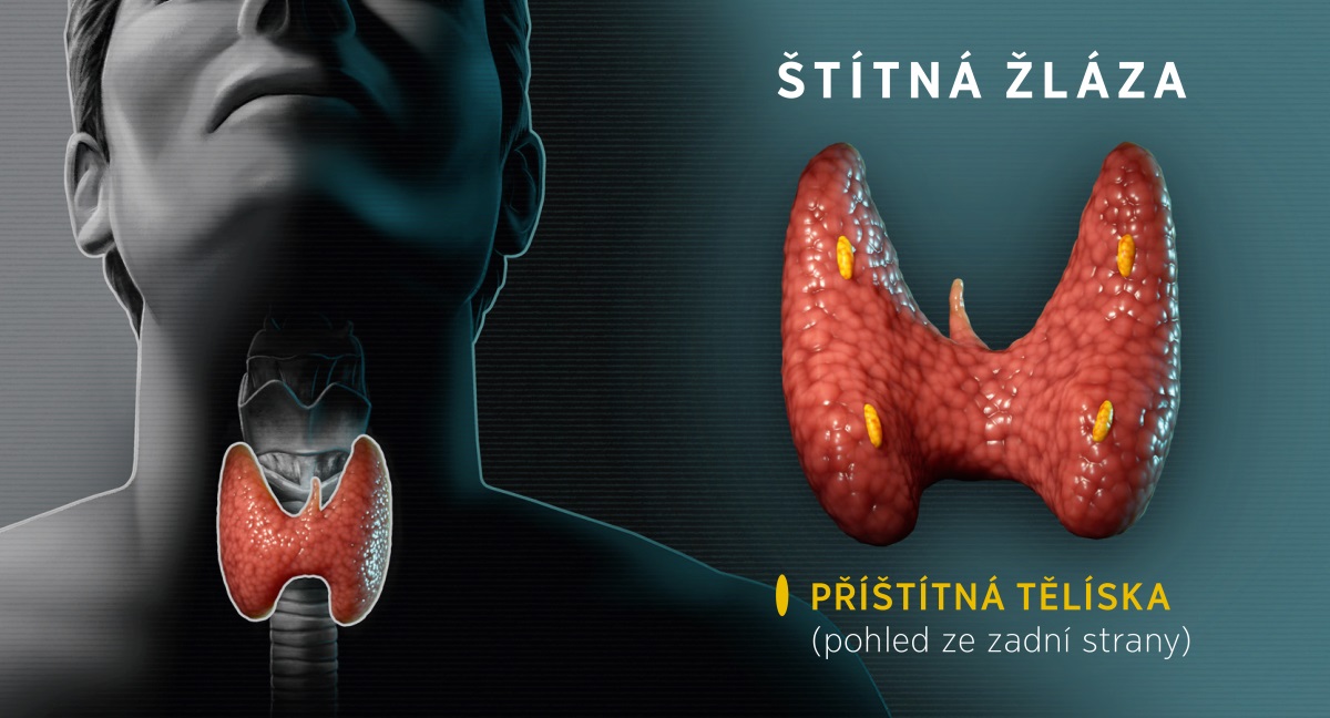 Koláž: Nákresy štítné žlázy. 1. Štítná žláza z přední strany a její umístění na krku. 2. Zadní strana štítné žlázy s příštítnými tělísky.