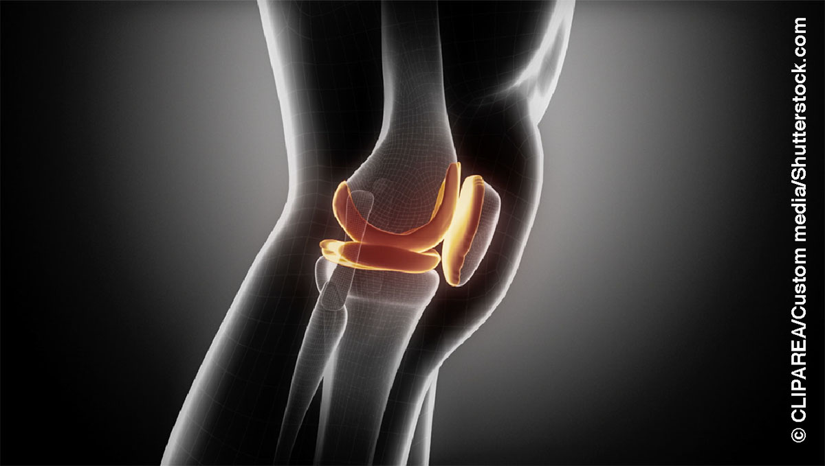 Imagen de los huesos de la rodilla