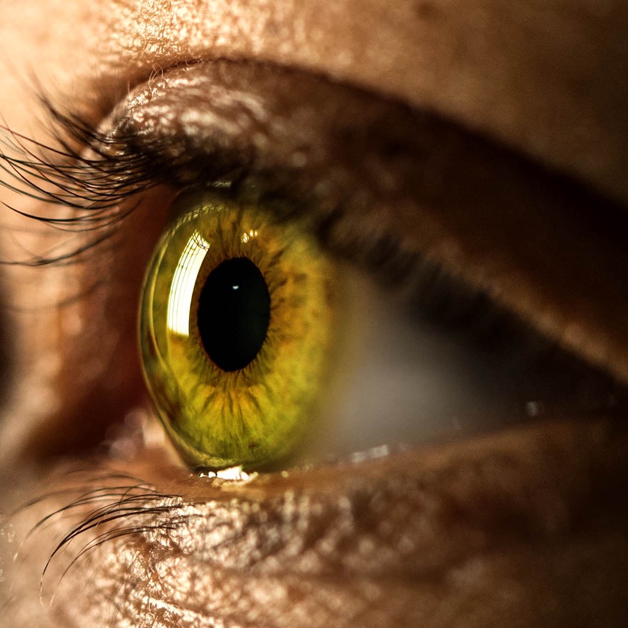 Un ojo humano.