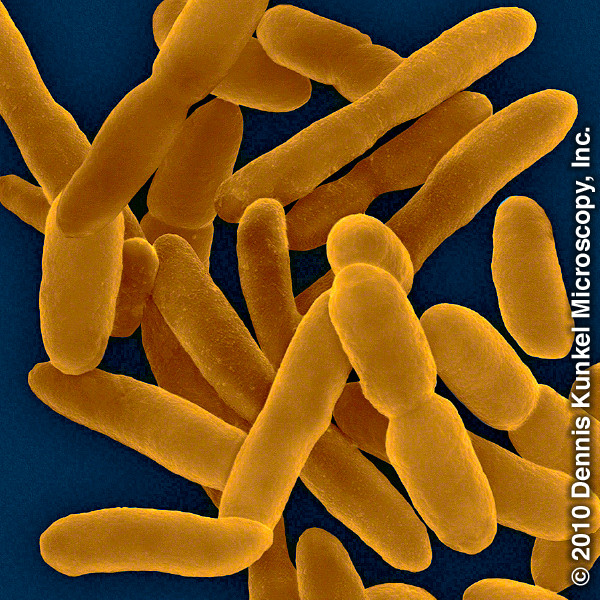 Bacterias que descomponen el petróleo