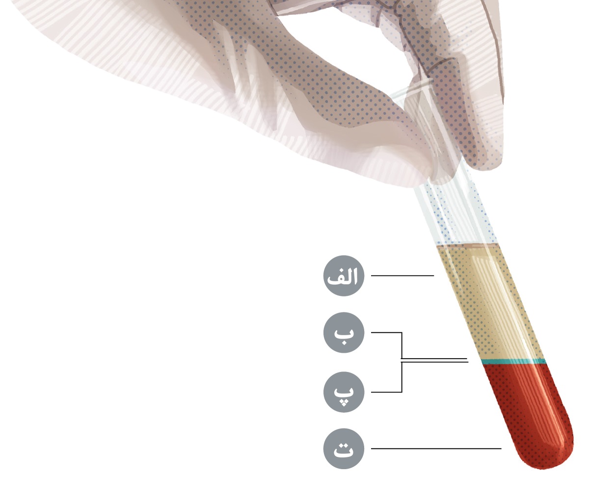 مقداری خون در یک لولهٔ آزمایشگاهی که به چهار بخش اصلی تقسیم و نامگذاری شده است.‏