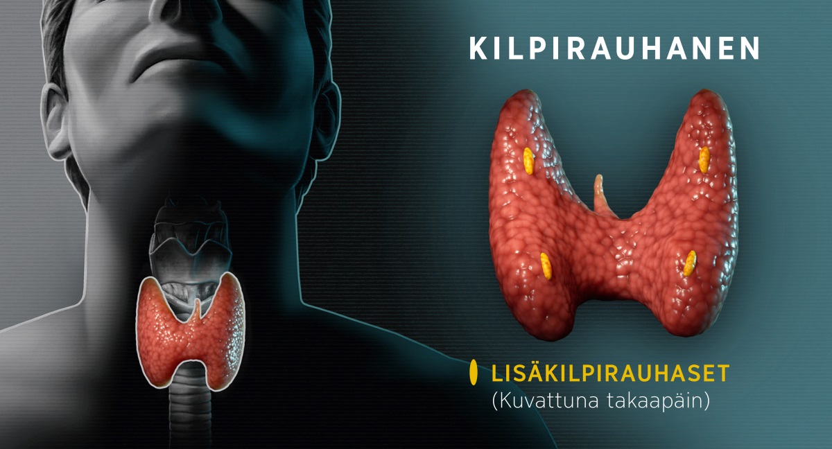 Kuvat: Havainnekuva kilpirauhasesta. 1. Kilpirauhasen paikka ihmisen kaulalla edestäpäin kuvattuna. 2. Kilpirauhanen takaapäin kuvattuna. Kuvassa näkyy myös lisäkilpirauhaset.