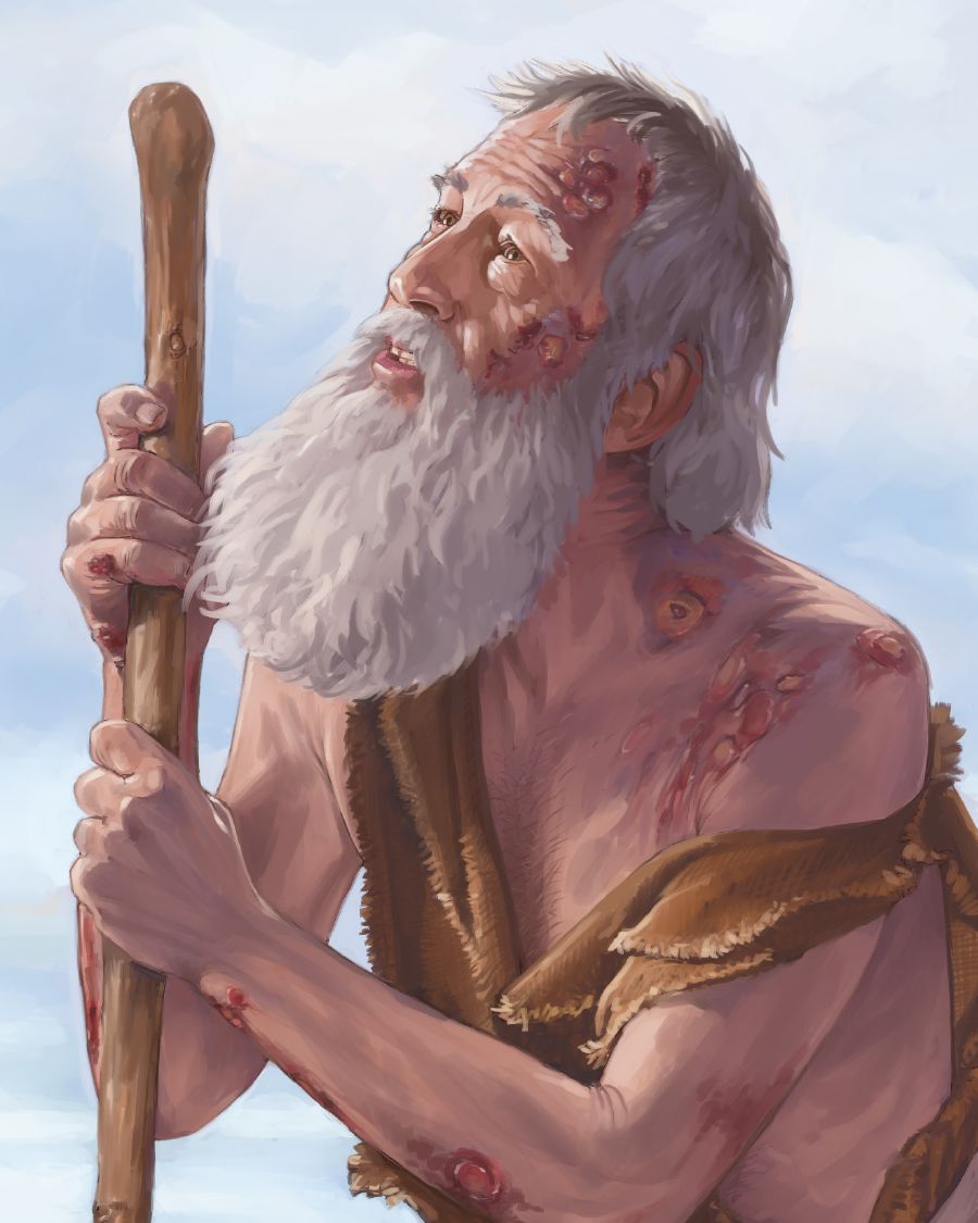 Job, jolla on paiseita kehossaan