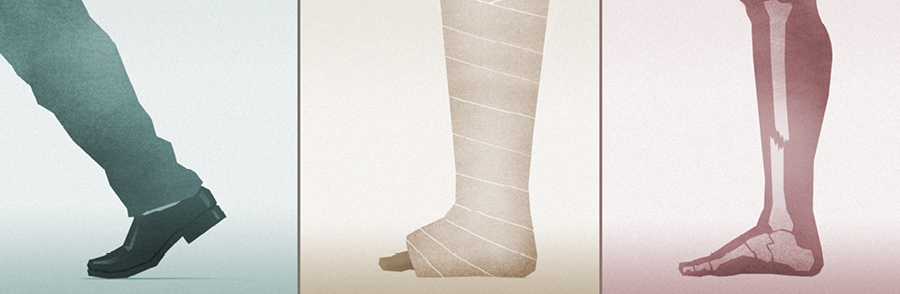 קולאז׳:‏ 1.‏ תמונת רנטגן של עצם רגל שבורה.‏ 2.‏ רגל בגבס.‏ 3.‏ גבר הולך אחרי שרגלו החלימה.‏