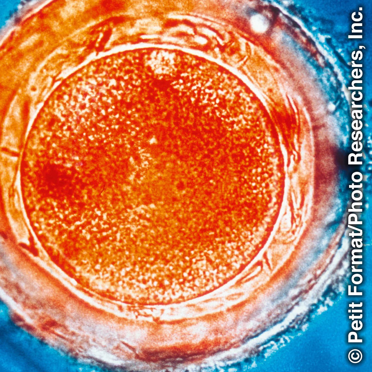 Cellula uovo umana fecondata