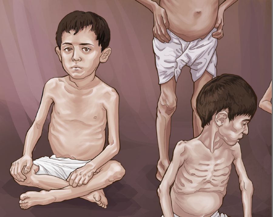 Зарʹед бьрʹчи