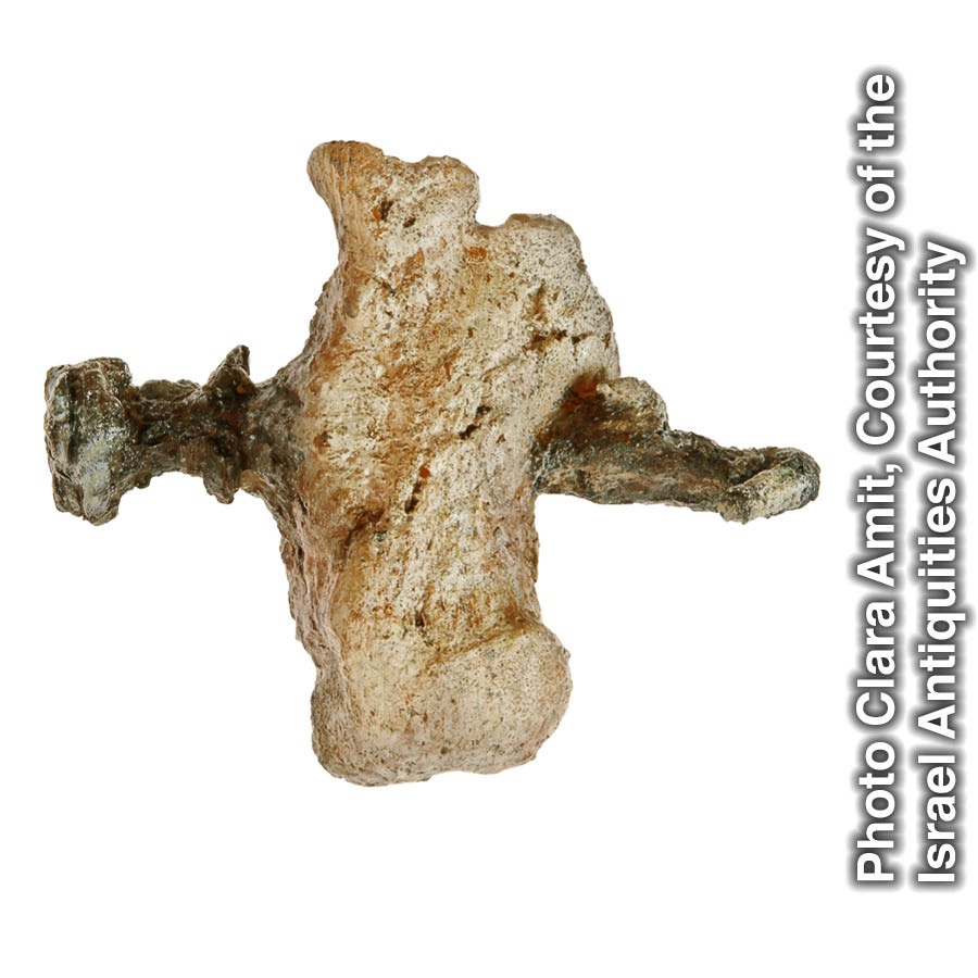 ဖနောင့်ရိုးထဲဝင်နေတဲ့ သံချောင်း