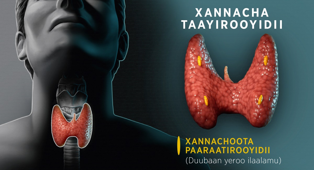 Fakkiiwwan garaa garaa: Diyaagiraamii xannacha taayirooyidii argisiisu. 1. Fakkii taayirooyidiin fuulduraan maal akka fakkaatu argisiisu; morma keenyarraa bakka kamitti akka argamu argisiisa. 2. Taayirooyidiin karaa duubaatiin mulʼatu xannachoota Paaraatirooyidii argisiisa.