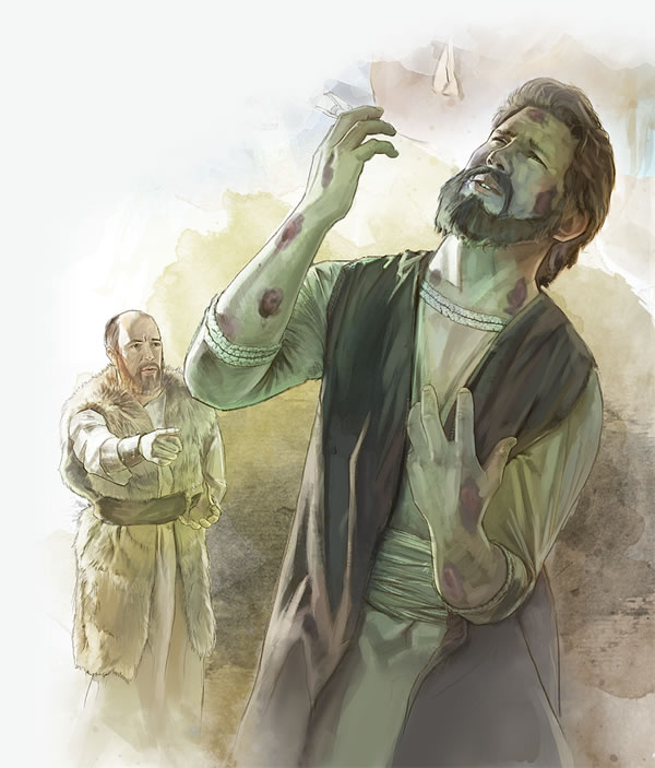 ගෙහාසිට ලාදුරු රෝගය හැදිලා