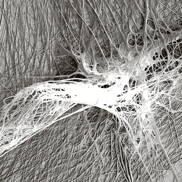 A spider’s scaffolding disc
