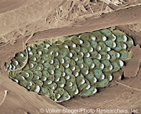 Izivamvo zikaqongqothwane othanda umlilo