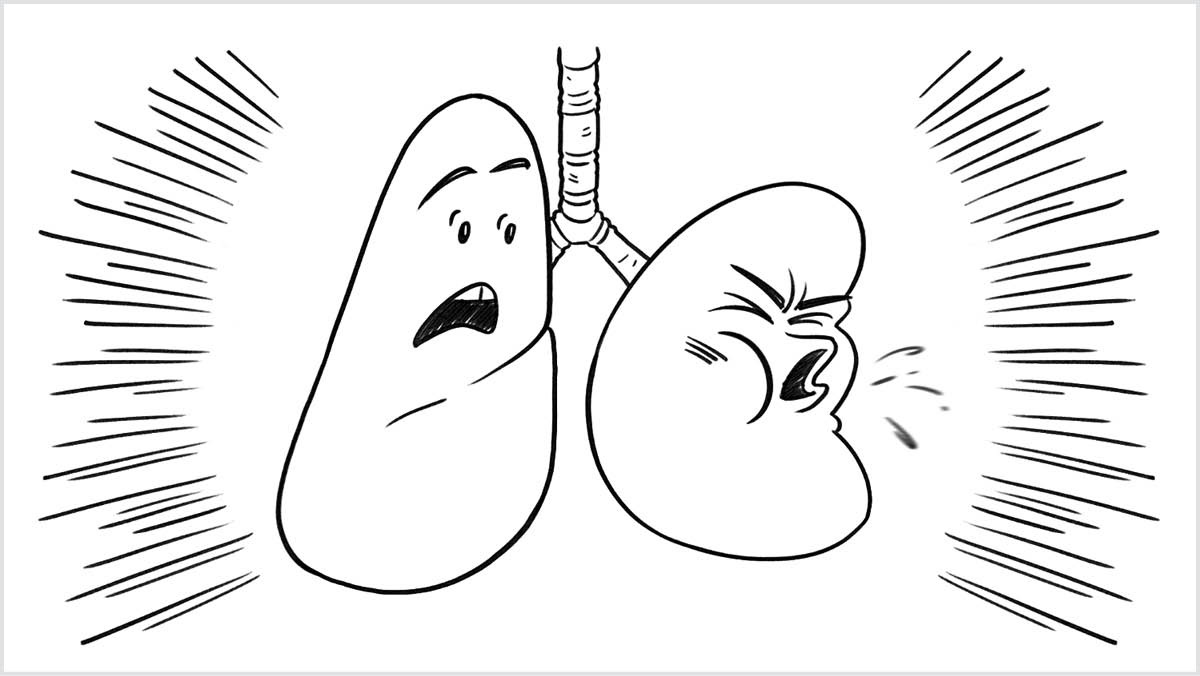 Indawo edlala kwividiyo ethi “Sukuvumela Ubomi Bakho Bumoshwe Kukutshaya.” Imiphunga yomntu otshayayo ikhohlela kabuhlungu.